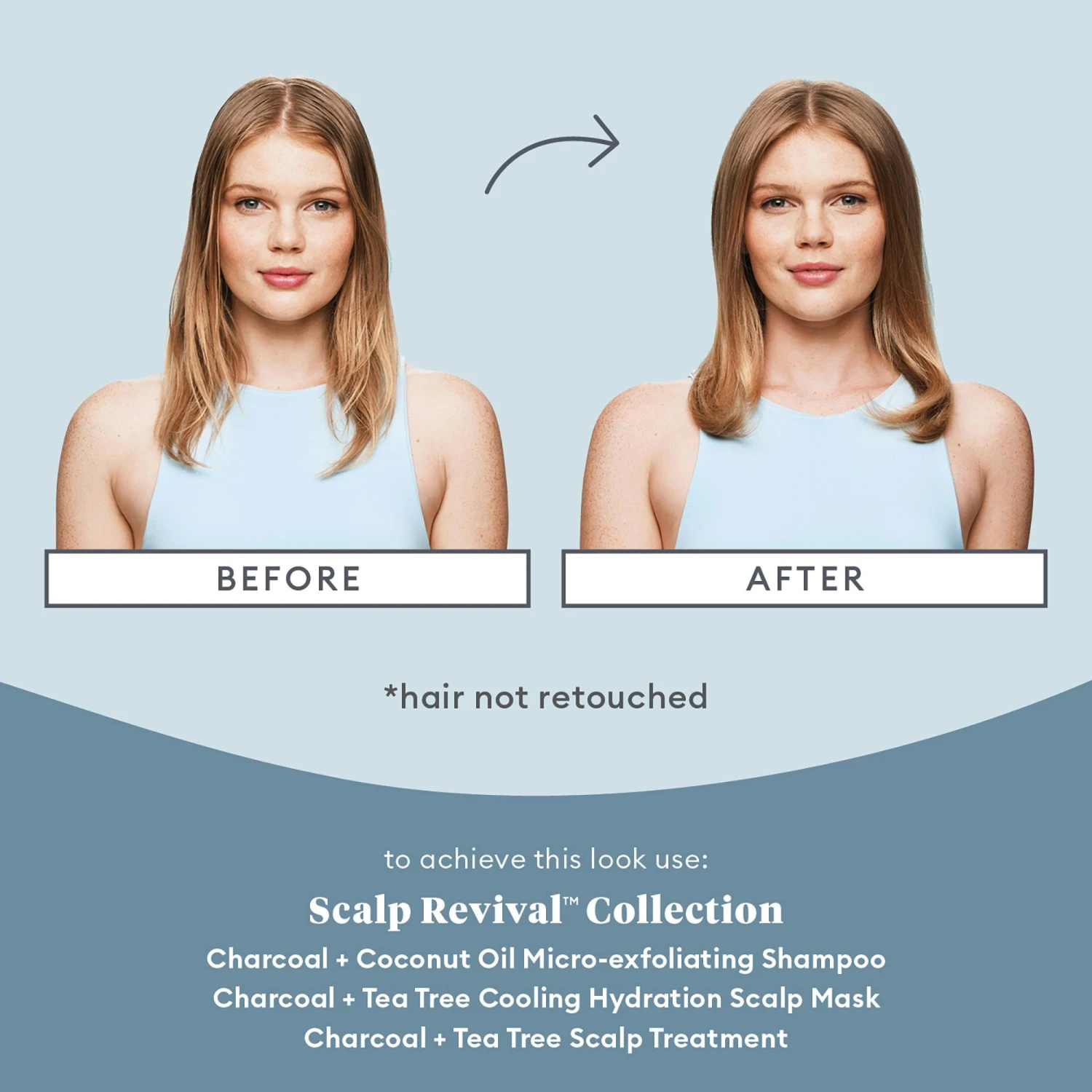 Scalp Soothing Solutions Set 2 Scalp Soothing Solutions Set - Bild 2