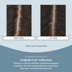 Scalp Soothing Solutions Set 6 Scalp Soothing Solutions Set -Redken Butik 102491 87255 1683714878