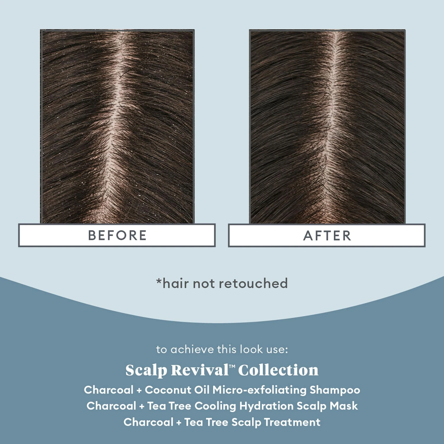 Scalp Soothing Solutions Set 3 Scalp Soothing Solutions Set - Bild 3