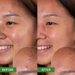 Oil Control Clearing Cleanser -Redken Butik 103835 87719 1685437104