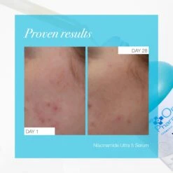 The Organic Pharmacy Niacinamide Ultra 5 Serum -Redken Butik 106305 87250 1687769955