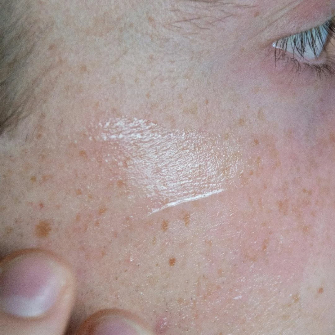 Clarifying Face Gel For Acne-Prone Skin 5 Clarifying Face Gel For Acne-Prone Skin - Bild 5